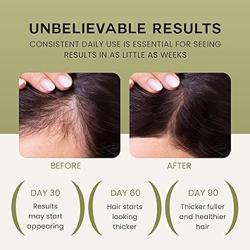 Lebanta Hair Growth Routine — product image 10