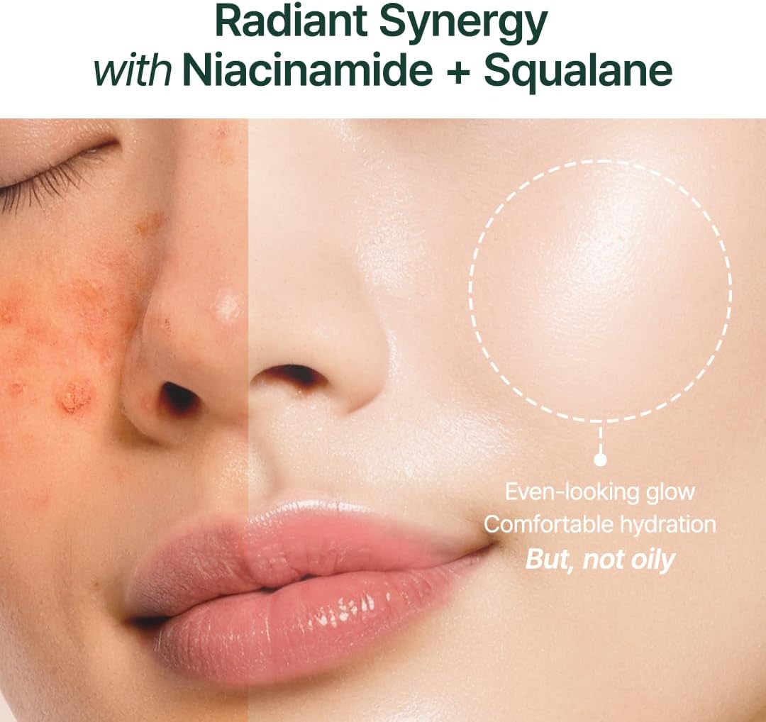 Before and after comparison of a person's face with text highlighting the benefits of Radiant Synergy with Niacinamide + Squalane.