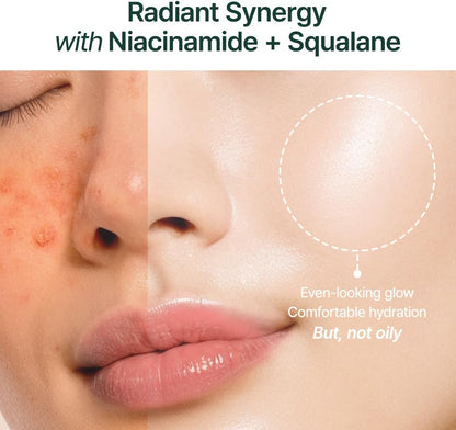 Before and after comparison of a person's face with text highlighting the benefits of Radiant Synergy with Niacinamide + Squalane.