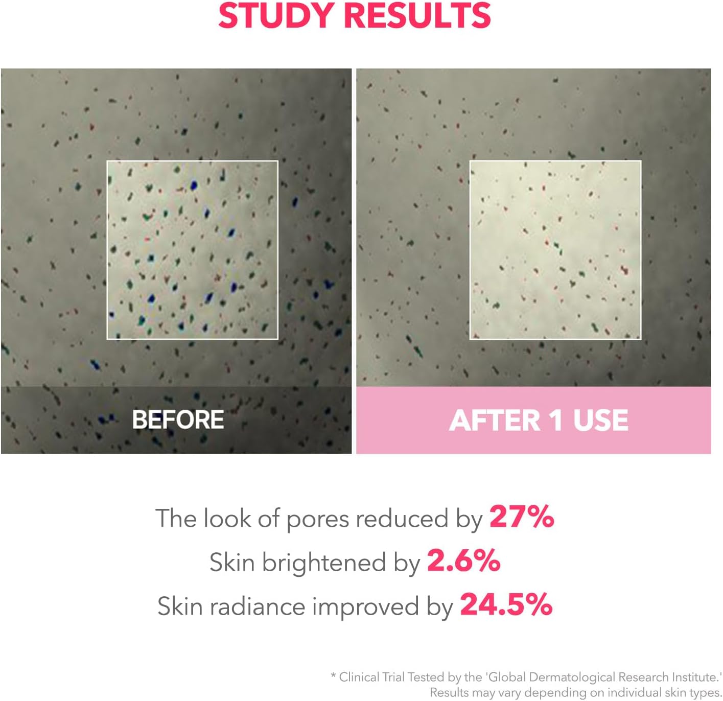 Before and after comparison of skin texture with study results on a white background