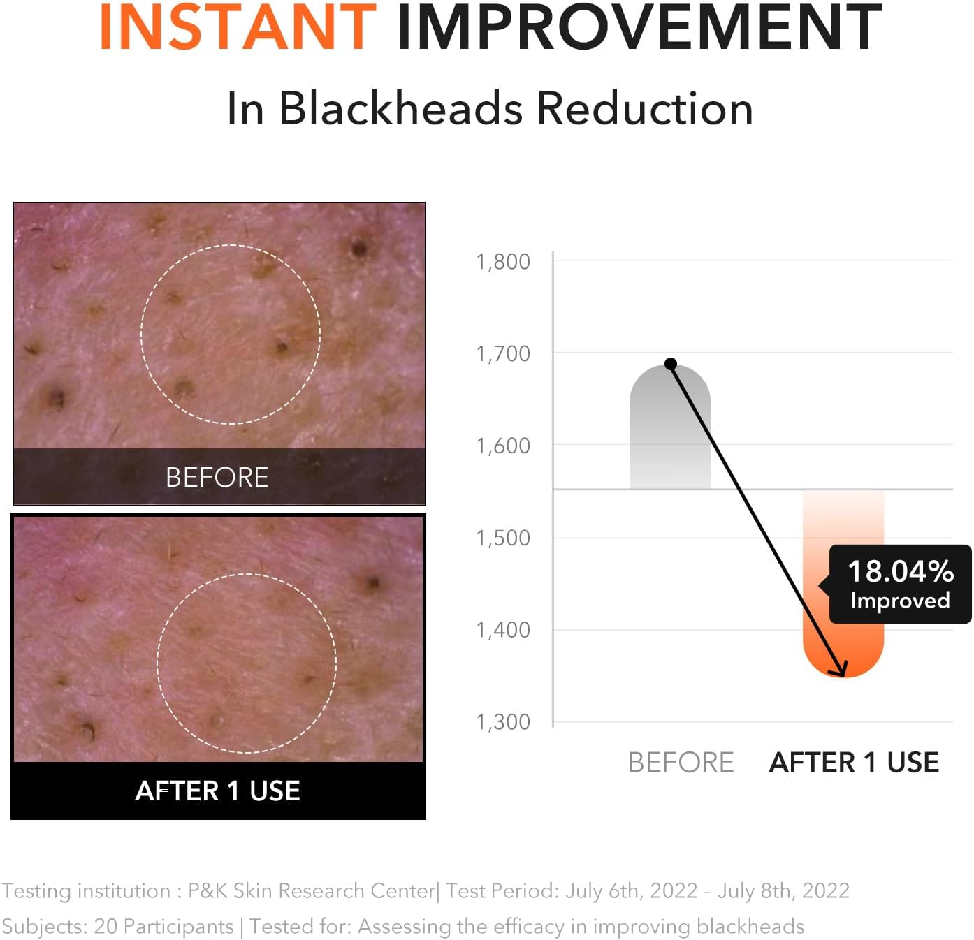 Before and after images of blackheads reduction with a graph showing improvement.