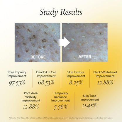 April Skin Real Calendula Peel Off Pack 100ml