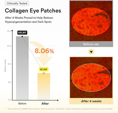 Collagen eye patches advertisement showing before and after effects on skin with a graph.