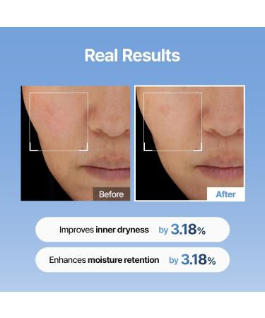 Meditherapy Hyaluronic Acid Skin Booster First Serum 150ml