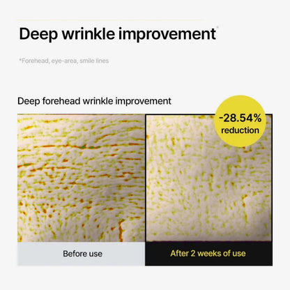 Before and after comparison of deep forehead wrinkles with a reduction percentage shown.