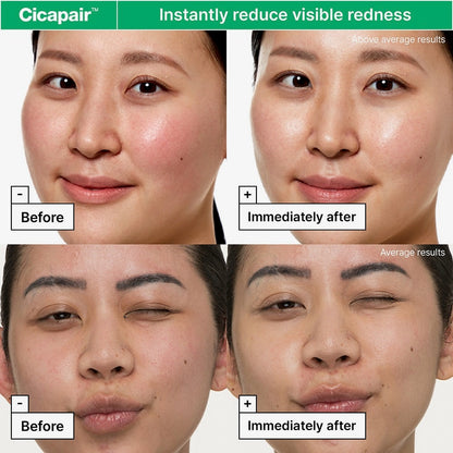 Before and after effects of Cicapair on visible redness with a person's face.