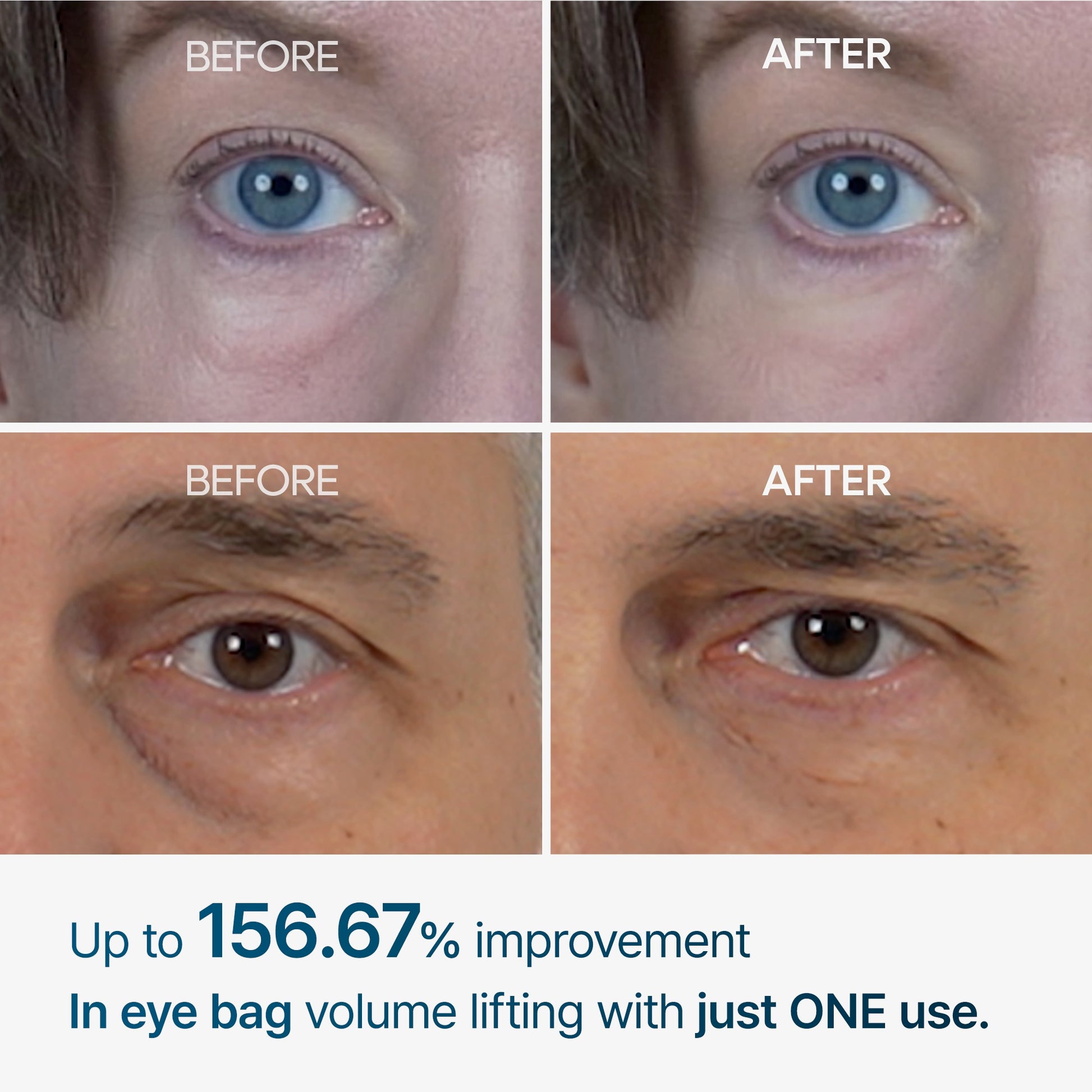 Before and after comparison of eye bags with text about improvement percentage.