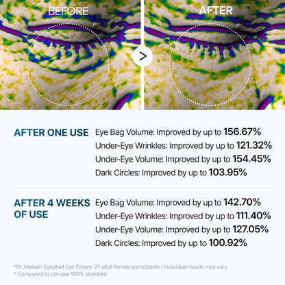 Before and after comparison of eye area treatment with text indicating improvement percentages.