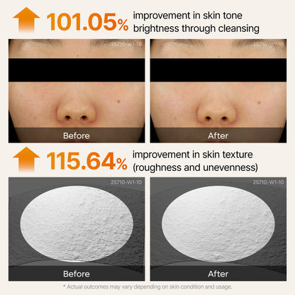 Before and after comparison of skin tone and texture improvement with cleansing.