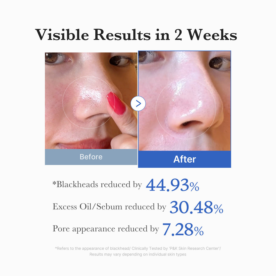 Medicube Zero Pore Blackhead Mud Mask 100g