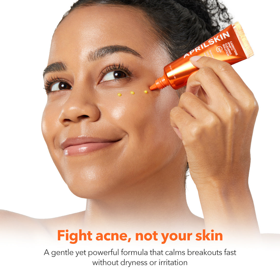 Person applying a skincare product to their face with text promoting acne treatment.