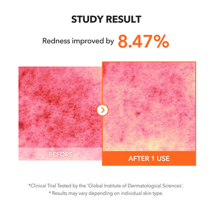 Before and after skin redness improvement study result with 8.47% improvement.