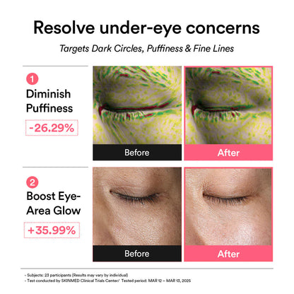 Before and after effects of a skincare product targeting under-eye concerns on a white background.
